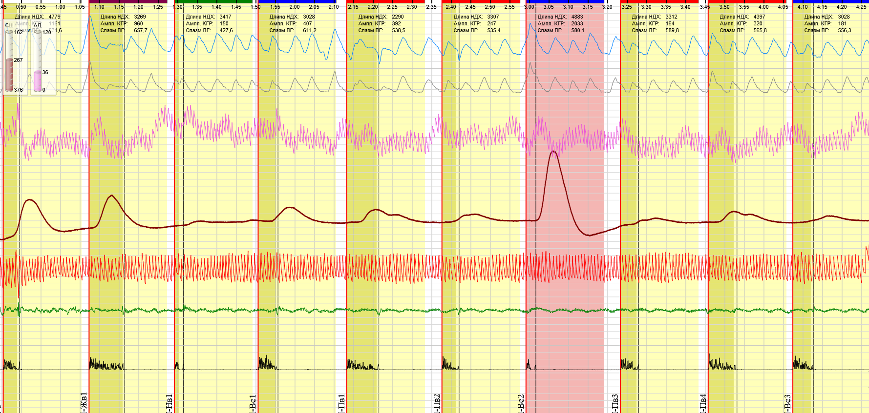 ЮТА(м) повтор 1